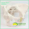 PELVIS03 (12340) Medical Anatomical Adult Female Pelvis Model, Anatomy Models > Male/Female Models